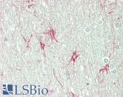IHC-plus™ Polyclonal Rabbit anti-Human OPN5 / Neuropsin Antibody (aa237-286, IHC, WB)