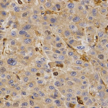 Polyclonal Rabbit anti-Human GHRH Antibody (IHC, WB)