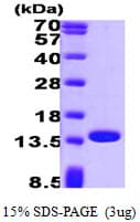 Human PFN1 / Profilin 1 Protein (Recombinant)