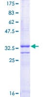 Human CD3G Protein (Recombinant GST, N-terminus)