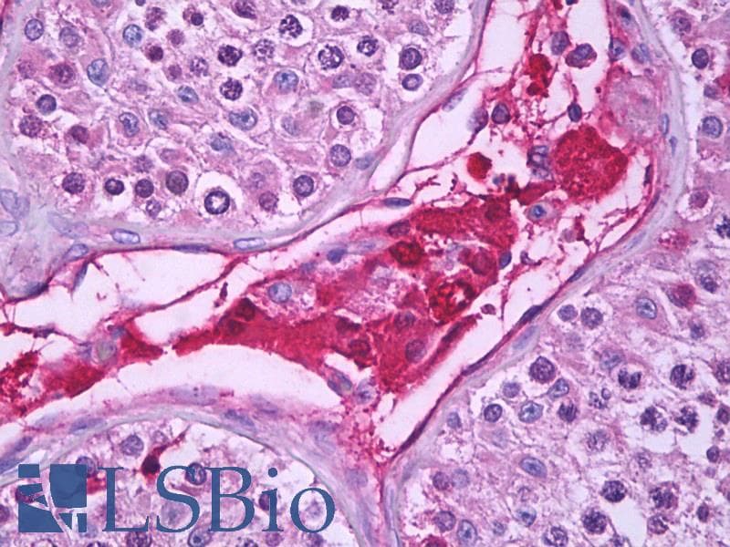 IHC-plus™ Polyclonal Rabbit anti-Human UCN / Urocortin Antibody (aa71-120, IHC)