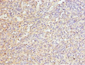 Polyclonal Rabbit anti-Human SFRP-3 / FRZB Antibody (IHC)