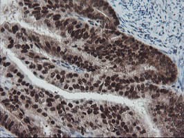 TPRKB Antibody (clone OTI3H3)