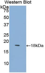 LY96 / MD2 / MD-2 Antibody (aa16-160)