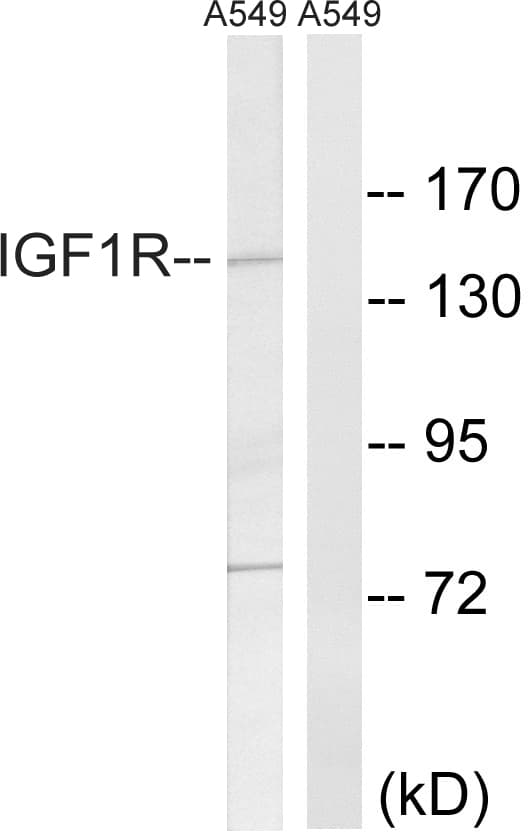 IGF1R / IGF1 Receptor Antibody (aa1311-1360)