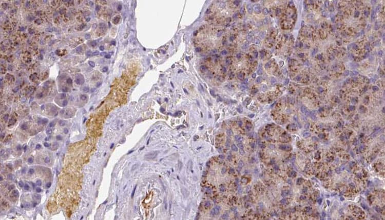 KCTD12 Antibody