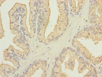 Polyclonal Rabbit anti-Human FAM78A Antibody (IHC, WB)