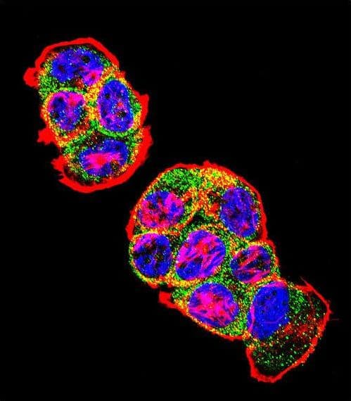 IHC-plus™ CTNNB1 / Beta Catenin Antibody (aa78-106)