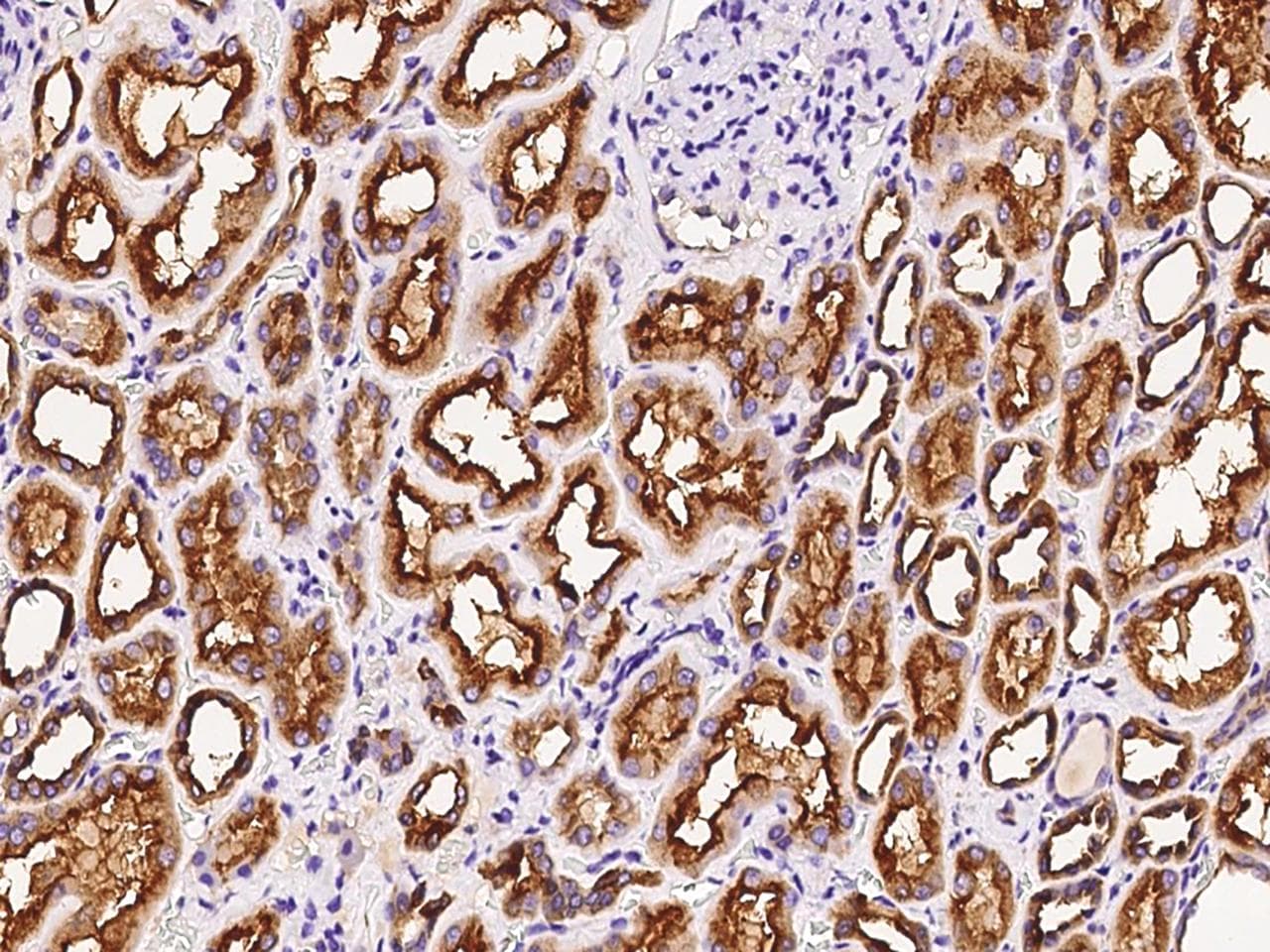 DCTD / dCMP Deaminase Antibody
