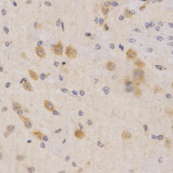 PDPK1 / PDK1 Antibody