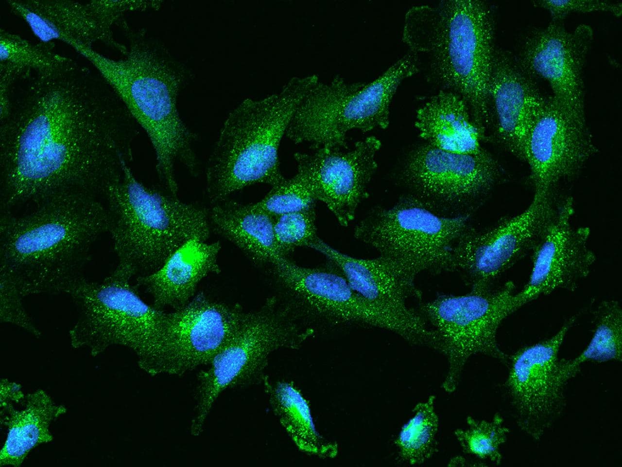 SLC26A2 Antibody