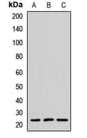 Polyclonal Rabbit anti-Human MYL6B Antibody (WB)