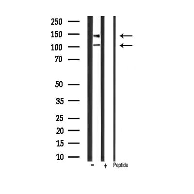IGF1R / IGF1 Receptor Antibody (phospho-Tyr1165,pTyr1166)