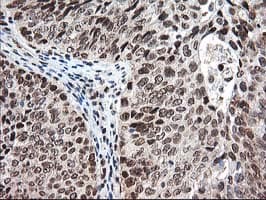 NUDT18 Antibody (clone OTI5D7)