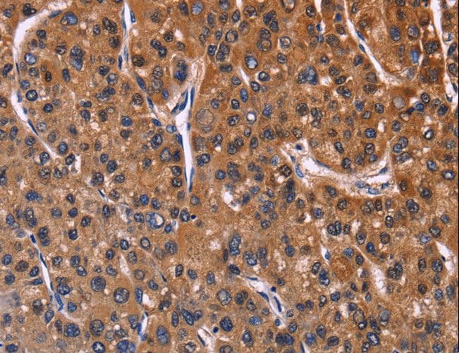 NFAT4 / NFATC3 Antibody