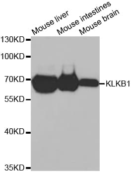 KLKB1 / Plasma Kallikrein Antibody