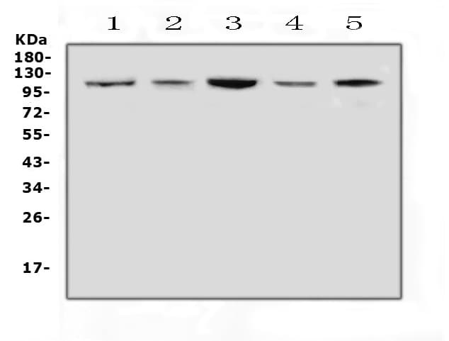 Polyclonal Rabbit anti-Human HSPH1 / HSP105 Antibody (IHC, WB)