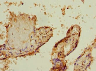 BCAP / PHF11 Antibody