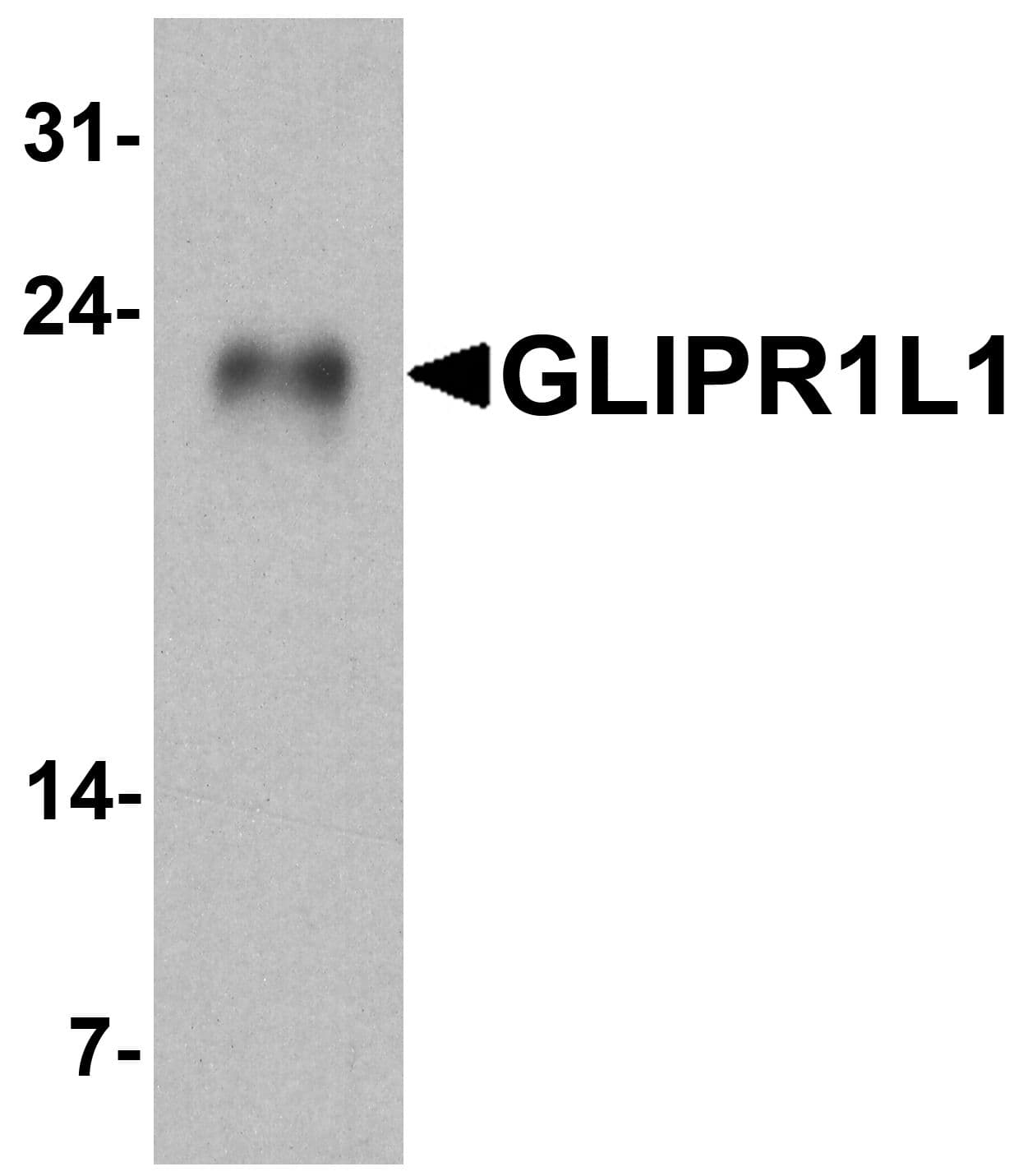 IHC-plus™ GLIPR1L1 Antibody