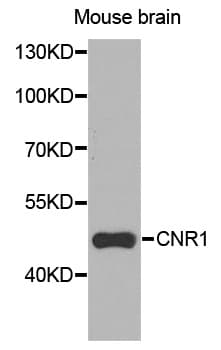 IHC-plus™ Polyclonal Rabbit anti-Human CNR1 / CB1 Antibody (IHC, WB)