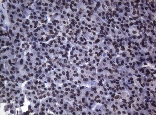 BCL6 Antibody (aa1-300, clone OTI1C3, Carrier-free)