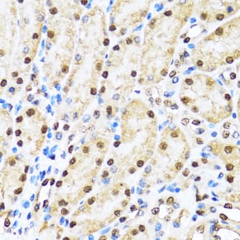 CCAR2 / KIAA1967 Antibody