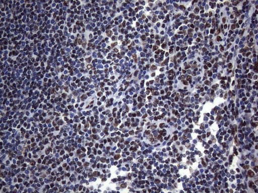 HnRNP A0 Antibody (aa139-183, clone OTI8H8)