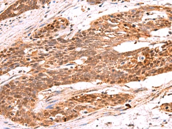RRP8 Antibody