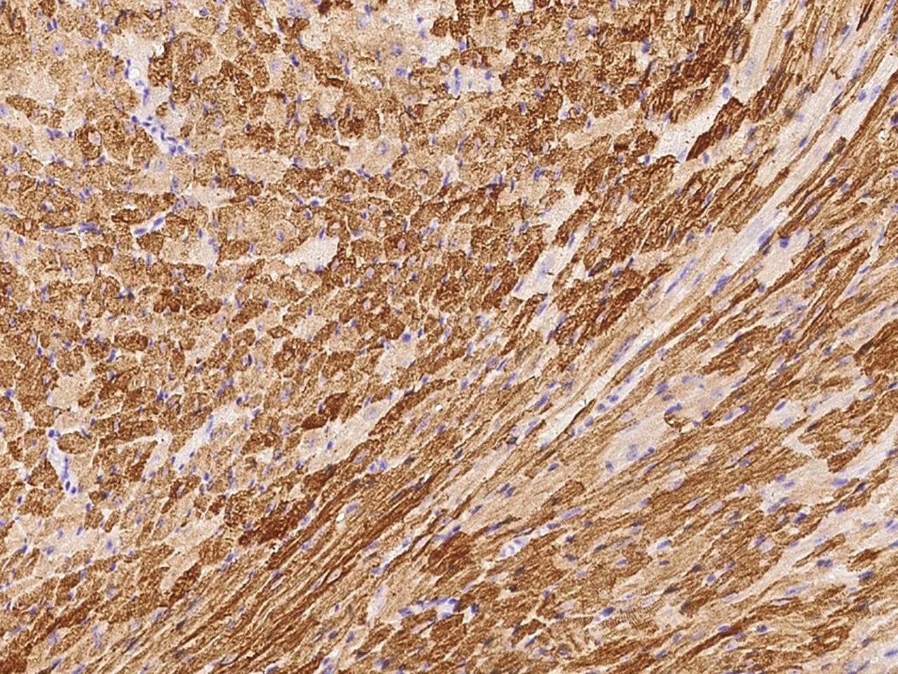Polyclonal Rabbit anti-Human MAPK6 / ERK3 Antibody (Preservative Free, IHC)
