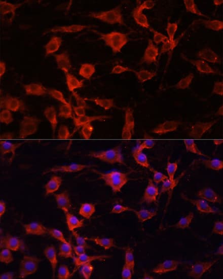 Polyclonal Rabbit anti-Human SERPINA1 / Alpha 1 Antitrypsin Antibody (IHC, IF, WB)