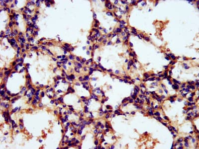 Polyclonal Rabbit anti-Human TNKS1BP1 / TAB182 Antibody (IHC, IF)