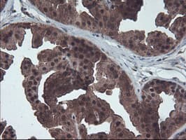HDHD1 Antibody (clone OTI7A2)
