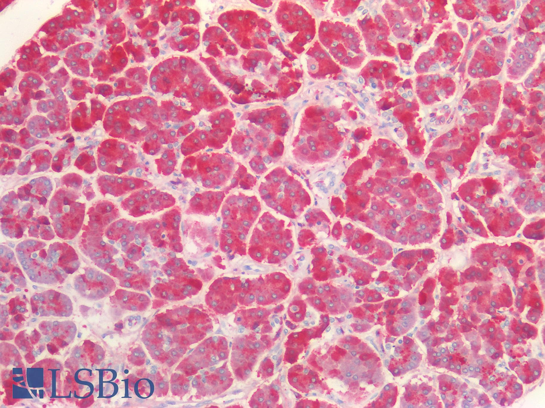 FGL1 / Hepassocin Antibody (aa23-314)