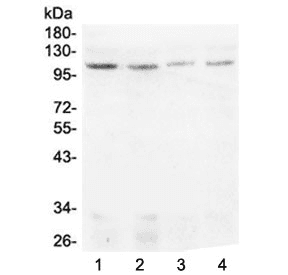 Polyclonal Rabbit anti-Human DIS3 Antibody (WB)