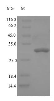Rat DPP4 / CD26 Protein (Recombinant 6His-SUMO, N-terminus)