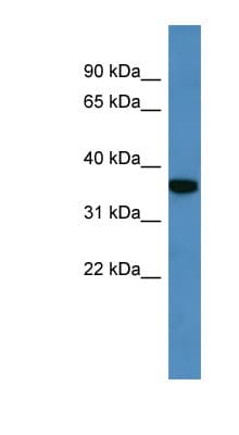 Polyclonal Rabbit anti-Mouse DECR2 Antibody (C-Terminus, WB)