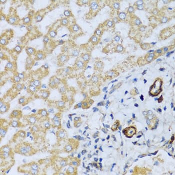 Polyclonal Rabbit anti-Human Placental Lactogen Antibody (IHC, WB)