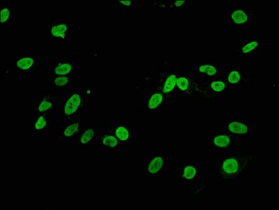Recombinant Monoclonal Rabbit anti-Human HIST1H3A Antibody (IF, WB)