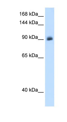 Mineralocorticoid Receptor Antibody (aa651-700)