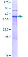Human SP2 Protein (Recombinant GST)