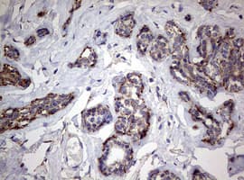 PIK3CD / PI3K Delta Antibody (aa286-610, clone OTI1D11)