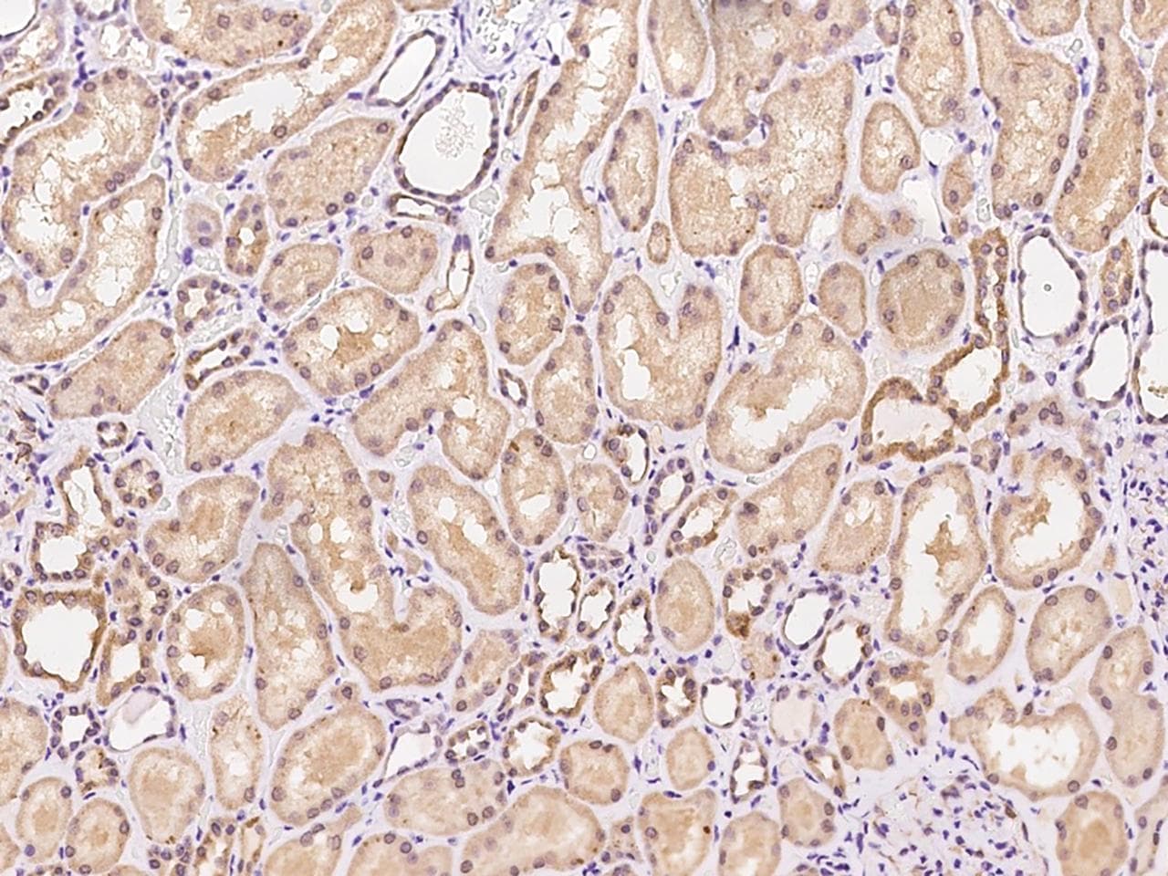 PGS1 Antibody