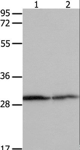 YWHAB / 14-3-3 Beta Antibody