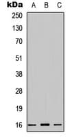 IHC-plus™ Polyclonal Rabbit anti-Human CST1 / Cystatin SN Antibody (Internal, IHC, IF, WB)