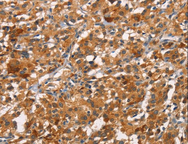 CDC25B Antibody