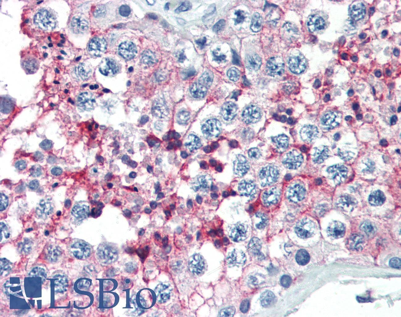 IHC-plus™ Monoclonal Mouse anti-Human Basigin / Emmprin / CD147 Antibody (IHC)