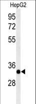 Polyclonal Rabbit anti-Human ACER3 Antibody (aa224-250, WB)