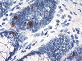 UNG / Uracil DNA Glycosylase Antibody (clone OTI2B5)