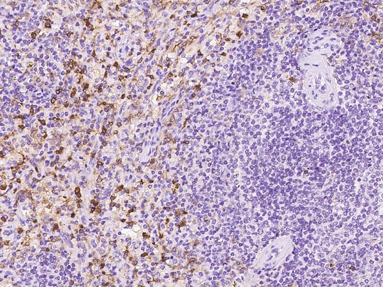 Polyclonal Rabbit anti-Human DAP12 Antibody (IHC)