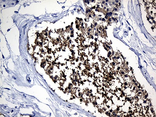 Monoclonal Mouse anti-Human MSY2 / YBX2 Antibody (clone OTI2D8, Carrier-free, IHC, WB)
